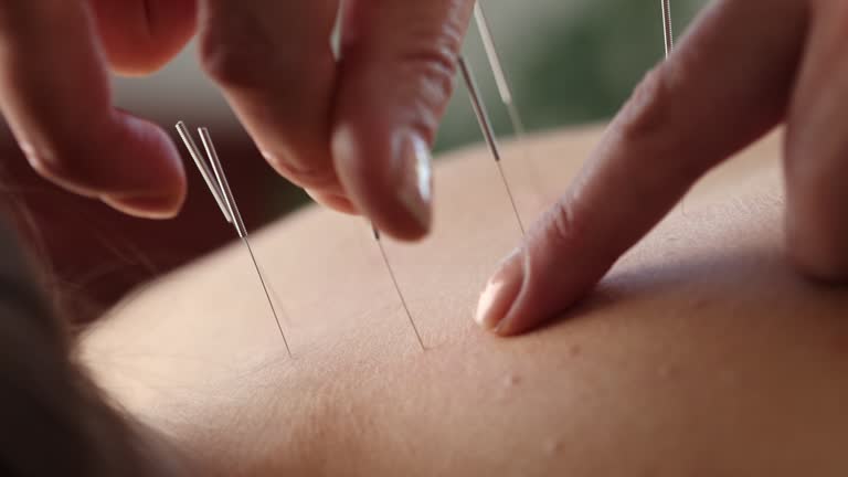 Acupuncture Training 5 acupuncture